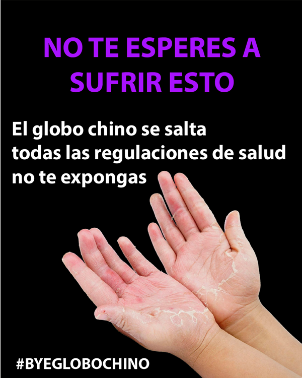 CONSECUENCIAS DE USAR GLOBOS CHINOS