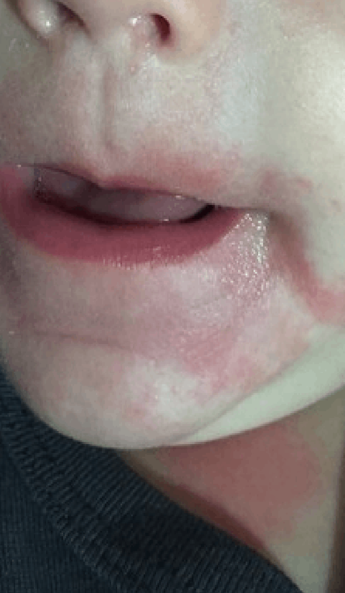 Descomposición de globos plásticos de origen chino en la naturaleza